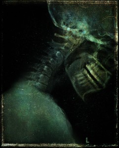 An x-ray in profile of a woman''s head and neck. Her skeleton merges with a field of stars and other vintage textures.